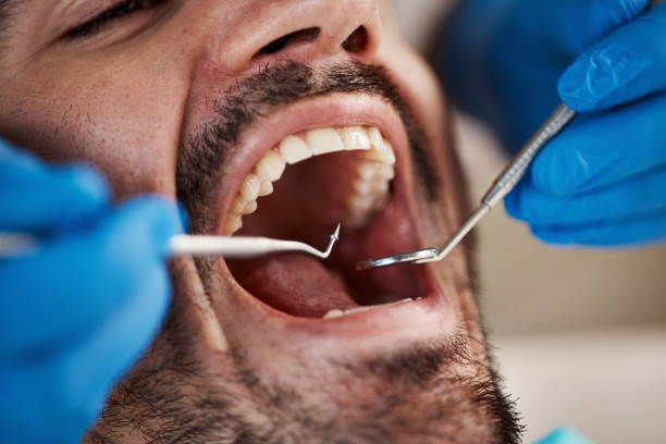 Best Emergency Denture Repair in Sistersville, WV
